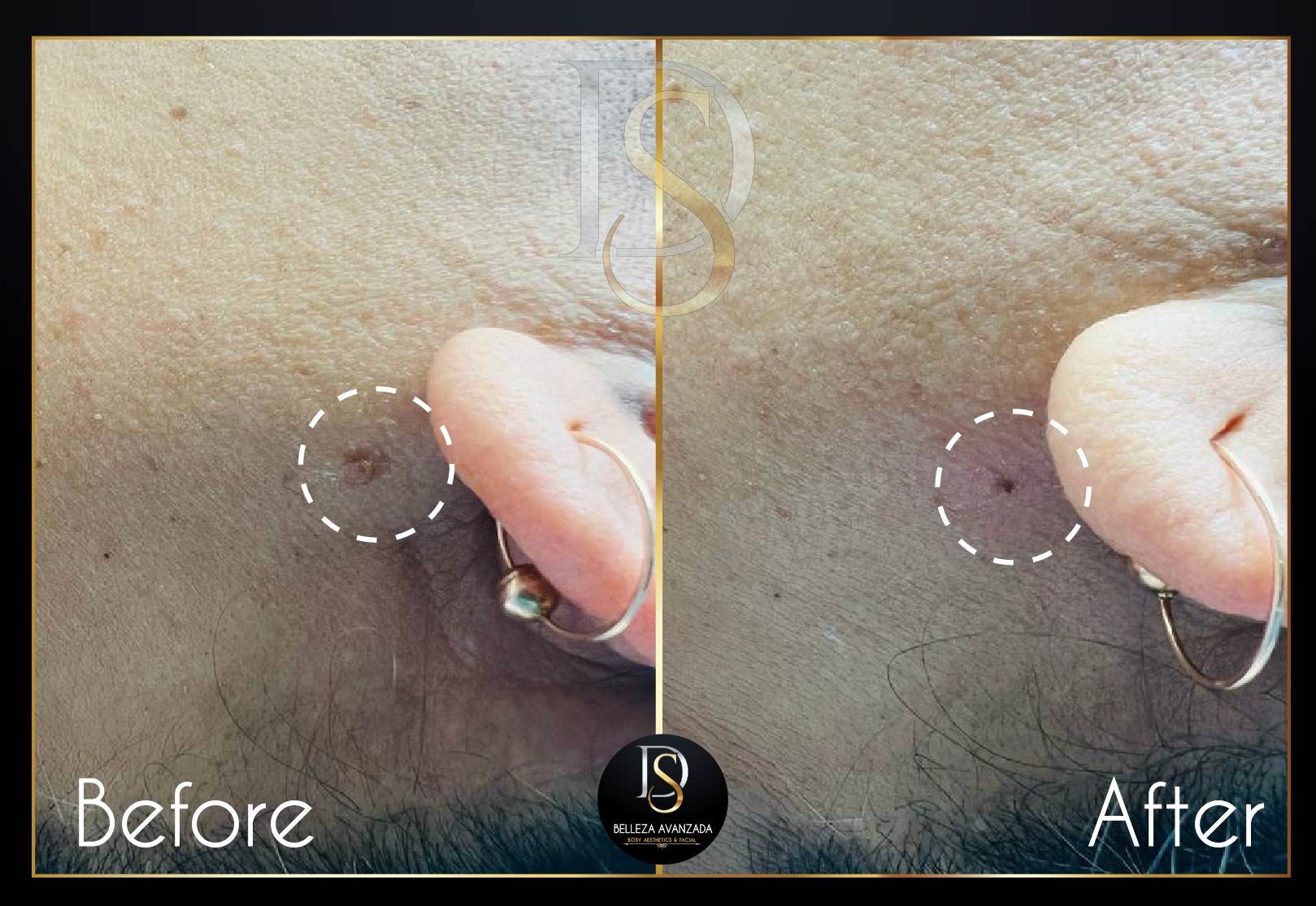 Before and after skincare results