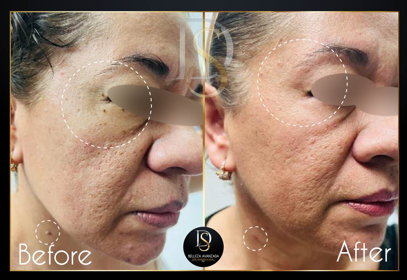 Before and after spot removal