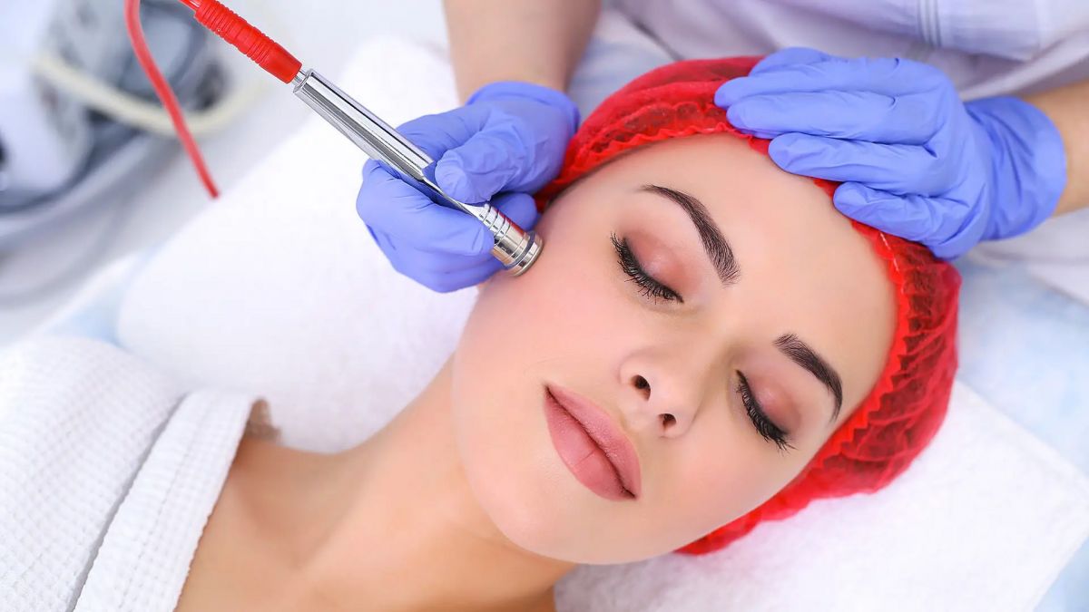 Procell microchanneling stem cell treatment