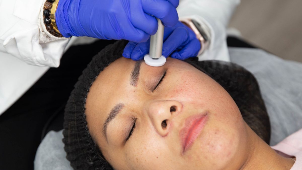 Microdermabrasion facial Dallas