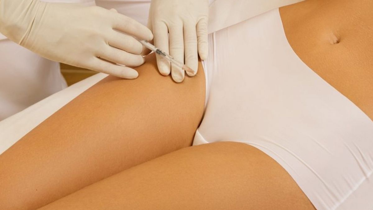 Mesotherapy treatment Dallas